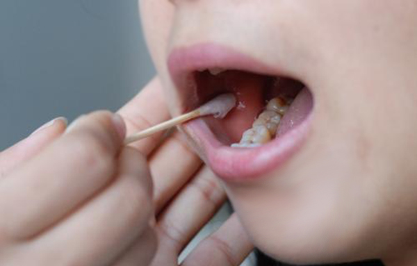 资阳上户亲子鉴定需要怎么做呢, 资阳上户亲子鉴定需要怎么做呢,