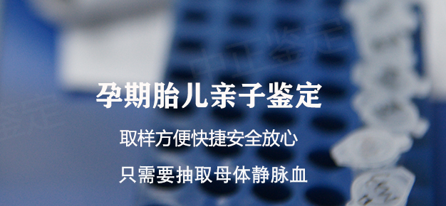 资阳怀孕亲子鉴定办理的条件, 资阳怀孕亲子鉴定办理的条件,