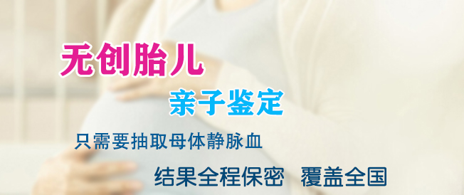 资阳孕期怎么偷偷做亲子鉴定,资阳孕期亲子鉴定准不准确 资阳孕期怎么偷偷做亲子鉴定,资阳孕期亲子鉴定准不准确